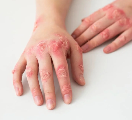 Skin Problems